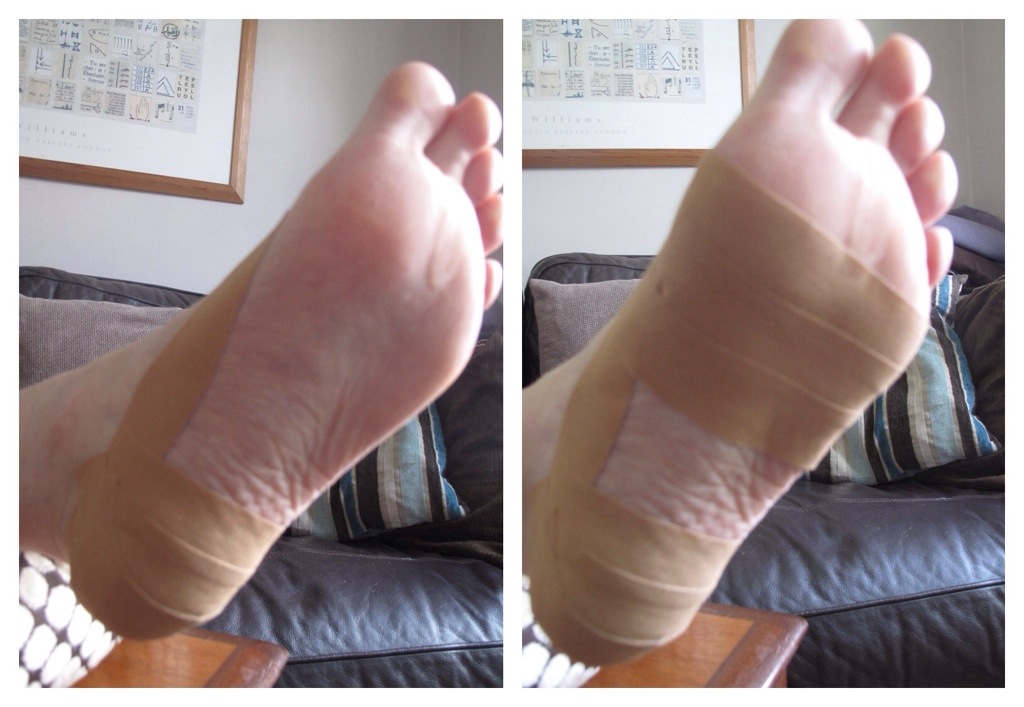 Foot Taping for Blister Prevention